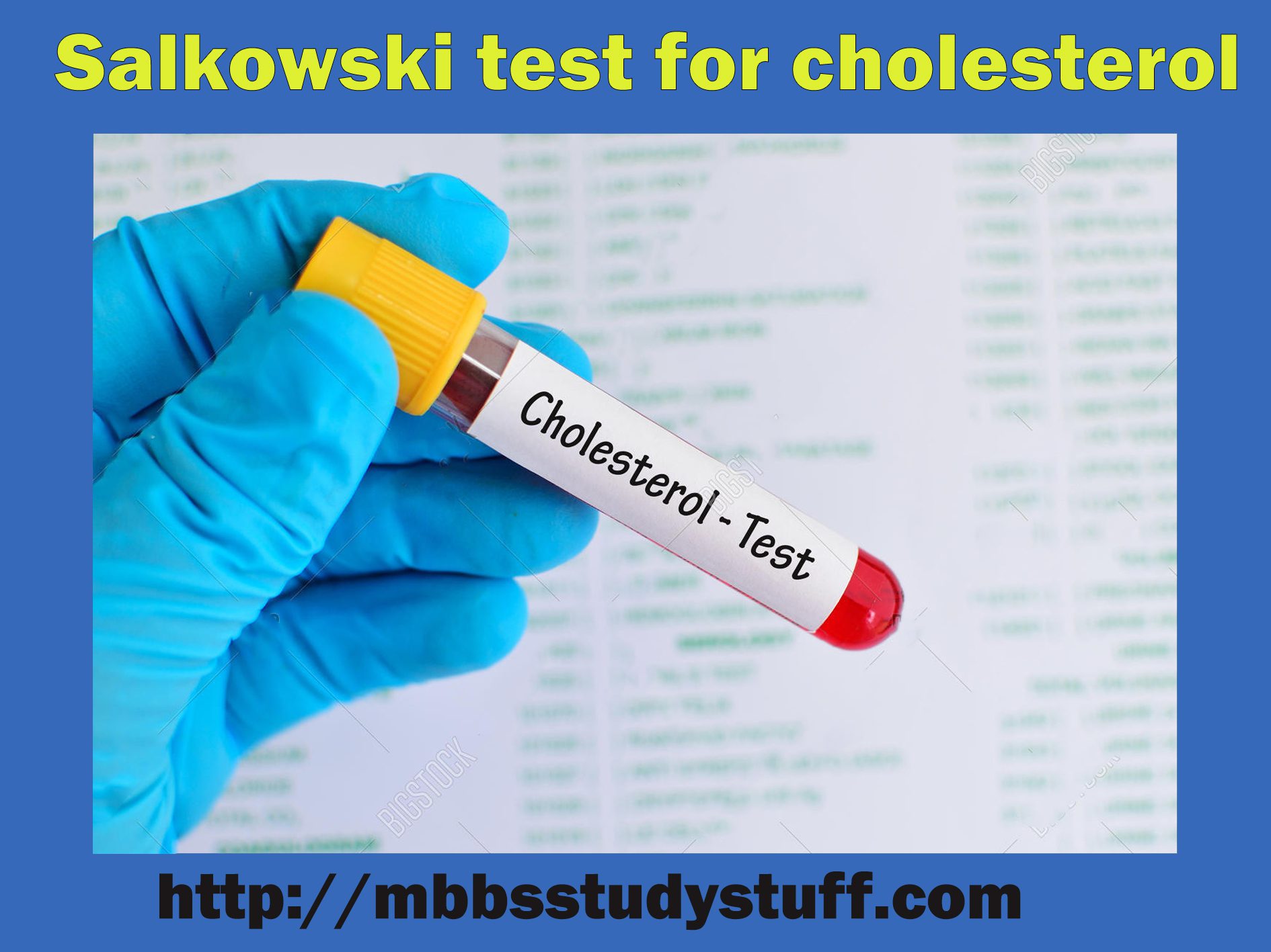 Salkowski test for cholesterol - Its principle and procedure