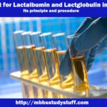 Test for Lactalbumin and Lactoglobulin in milk