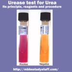 Urease test for Urea