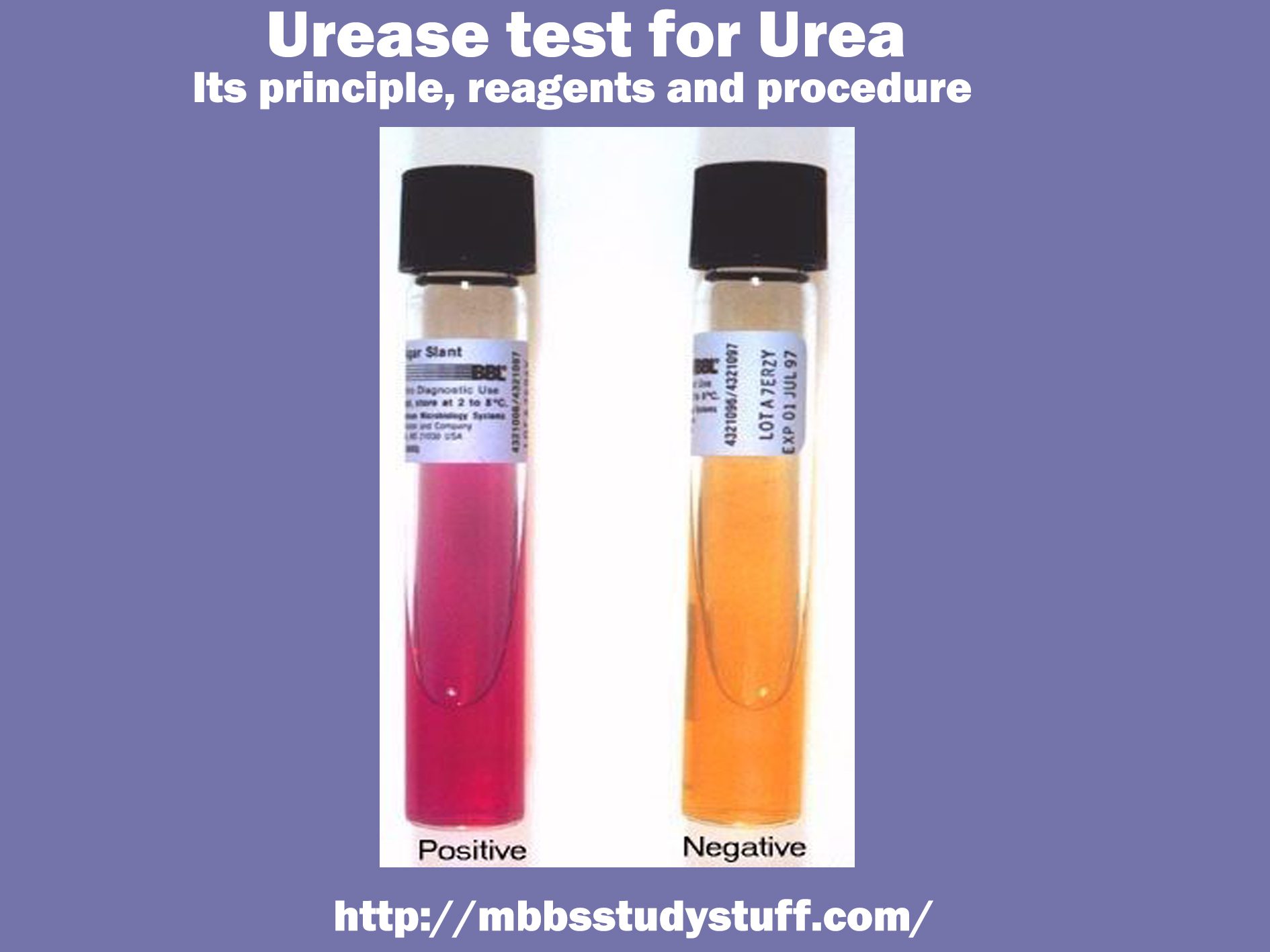 Urease test for Urea