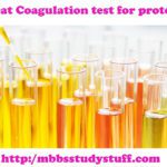 Heat Coagulation test for protein