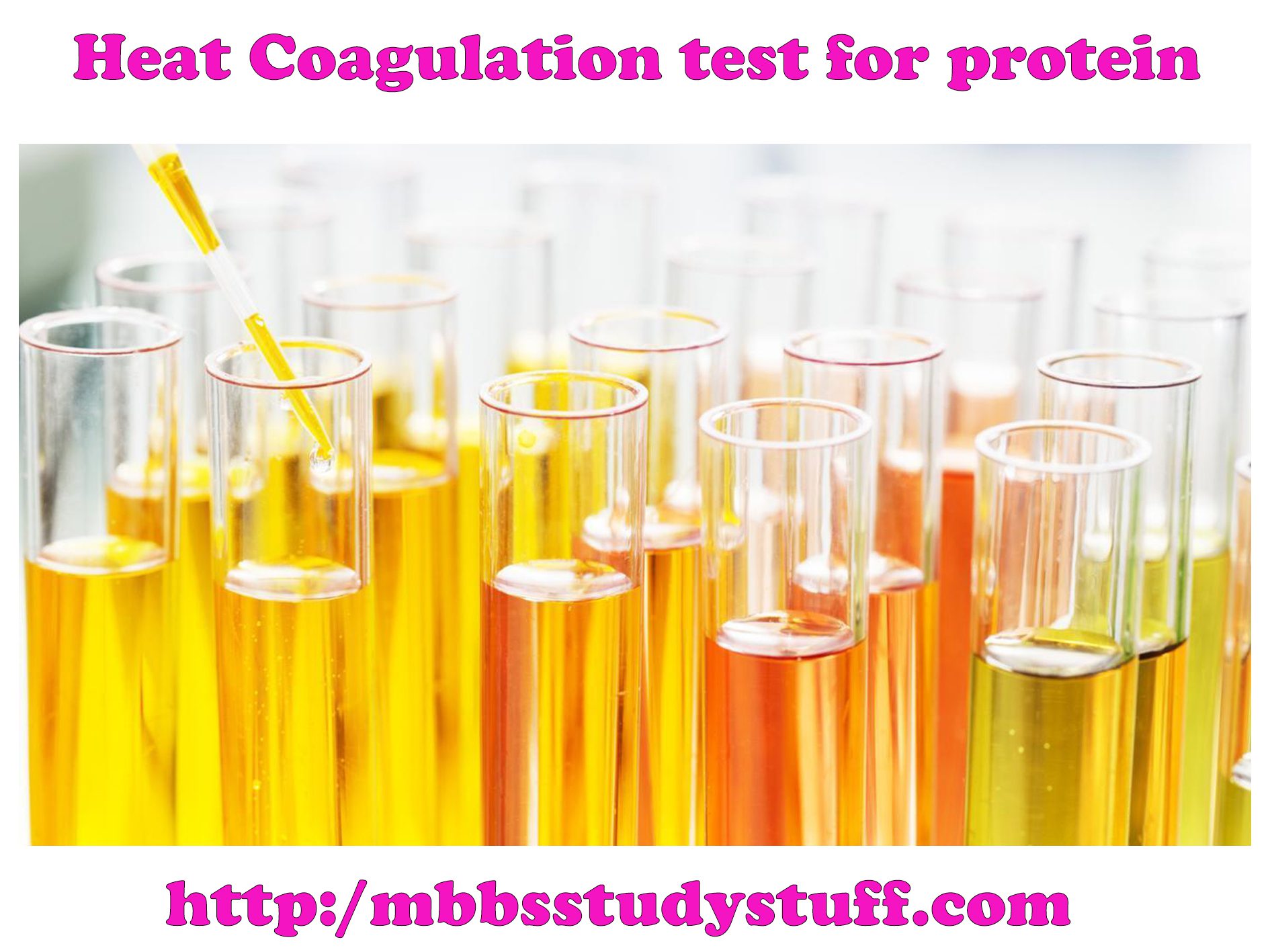 Heat Coagulation test for protein