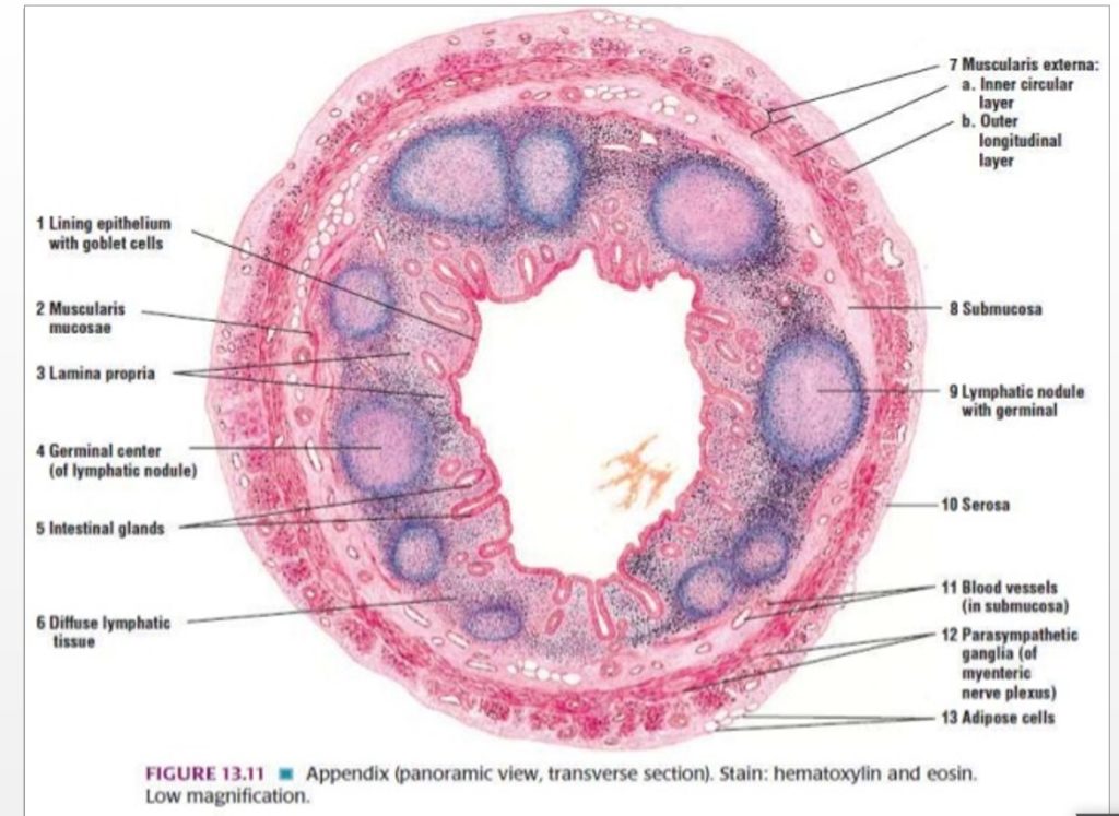 Pathology of Acute Appendicitis - Its Etiology, Morphology, Gross Appearance & Microscopic view
