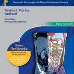 Download Pocket Atlas of Sectional Anatomy By Torsten B. Moeller PDF Free