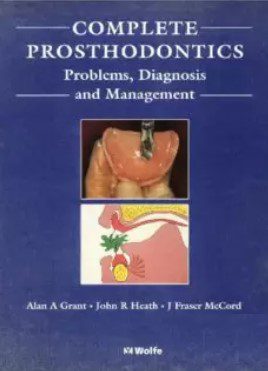 Complete Prosthodontics: Diagnosis and Management