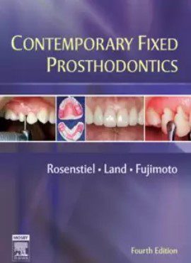 Contemporary fixed prosthodontics