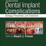 Dental Implant Complications Second Edition PDF Free Download