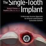 Download The Single-Tooth Implant: A Minimally Invasive Approach for Anterior and Posterior Extraction Sockets 1st Edition PDF Free