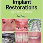 Implant Restorations: A step by step Guide 4th Edition PDF Free Download