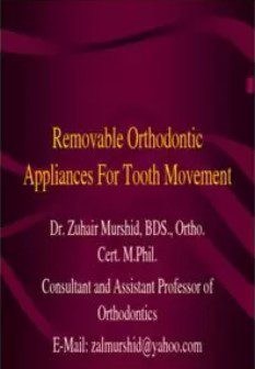 Removable Orthodontic Removable Orthodontic Appliances For Tooth Movement pp