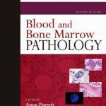 Download Blood and Bone Marrow Pathology 2nd Edition PDF Free