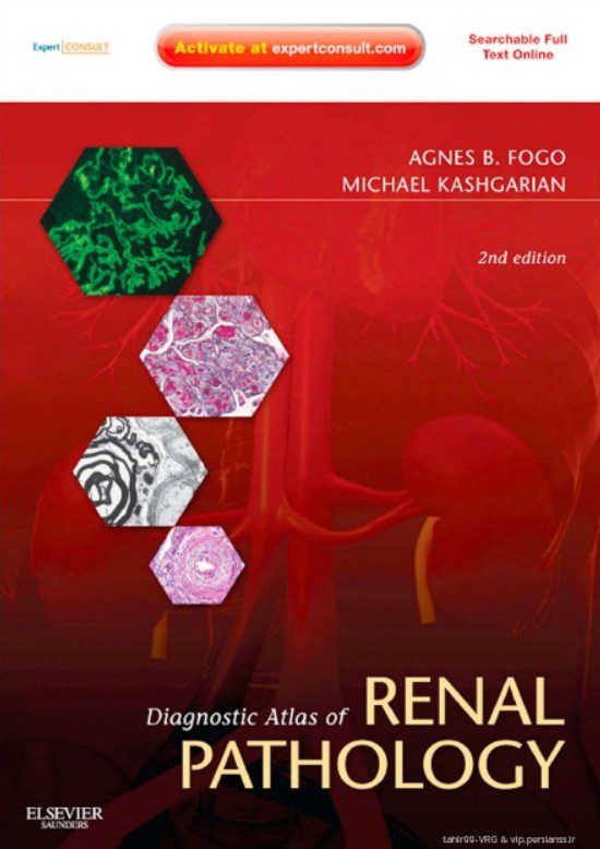 Download Diagnostic Atlas of Renal Pathology 2nd Edition PDF Free