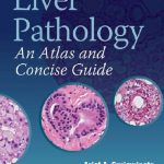 Download Liver Pathology: An Atlas and Concise Guide PDF Free