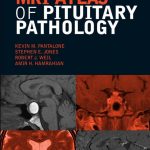 Download MRI Atlas of Pituitary Pathology 1st Edition PDF Free