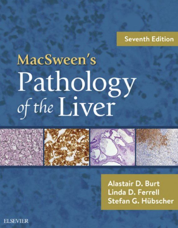 Download MacSween’s Pathology of the Liver 7th Edition PDF Free