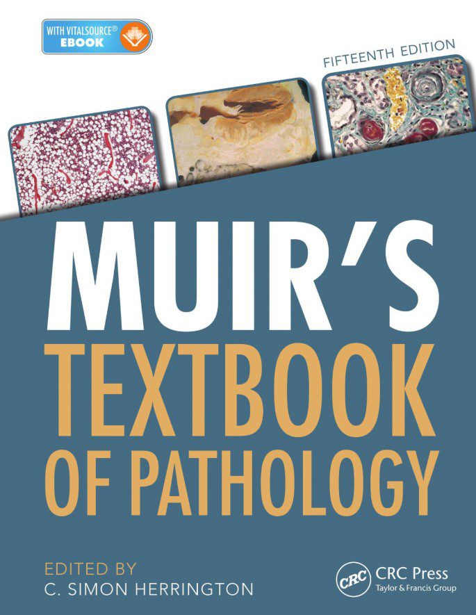 Download Muir’s Textbook of Pathology 15th Edition PDF Free