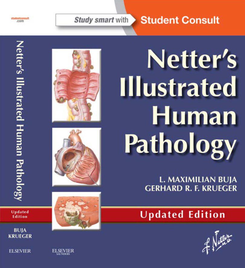 Download Netter’s Illustrated Human Pathology Updated Edition PDF Free