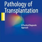 Download Pathology of Transplantation: A Practical Diagnostic Approach PDF Free