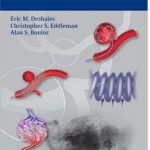 Download Handbook of Neuroendovascular Surgery 1st Edition PDF Free