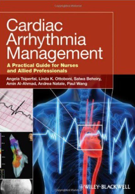 Cardiac Arrhythmia Management: A Practical Guide for Nurses and Allied Professionals PDF Free Download