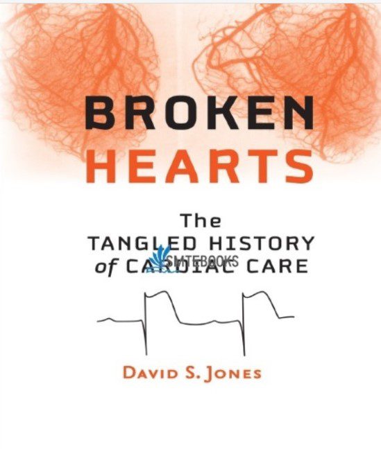 Download Broken Hearts: The Tangled History of Cardiac Care 1st Edition PDF Free