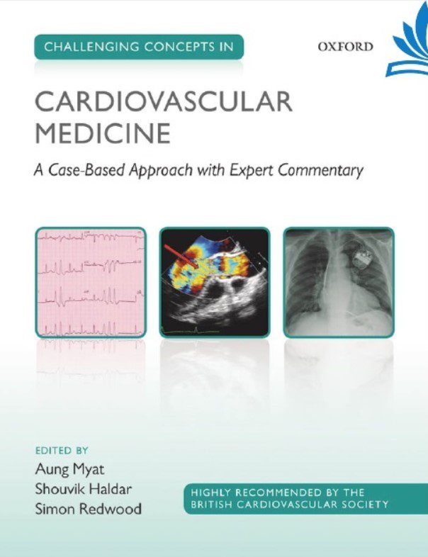 Download Challenging Concepts in Cardiovascular Medicine: Cases with Expert Commentary PDF Free