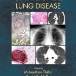 Download Clinical Handbook of Interstitial Lung Disease PDF Free