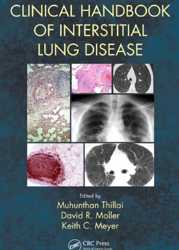 Download Clinical Handbook of Interstitial Lung Disease PDF Free