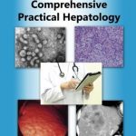 Download Comprehensive Practical Hepatology PDF Free