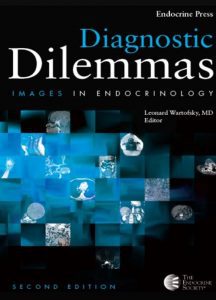 Download Diagnostic Dilemmas: Images In Endocrinology 2nd Edition PDF Free