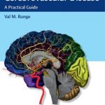 Download Imaging of Cerebrovascular Disease: A Practical Guide 1st Edition PDF Free