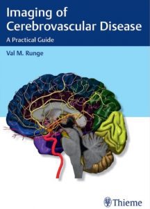 Download Imaging of Cerebrovascular Disease: A Practical Guide 1st Edition PDF Free