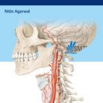Download Neurosurgery Fundamentals 1st Edition PDF Free