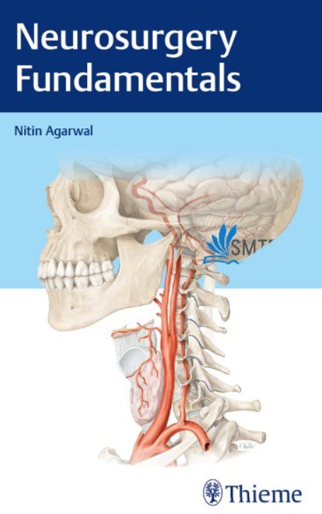 Download Neurosurgery Fundamentals 1st Edition PDF Free