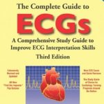 Download The Complete Guide to ECGs 3rd Edition PDF Free