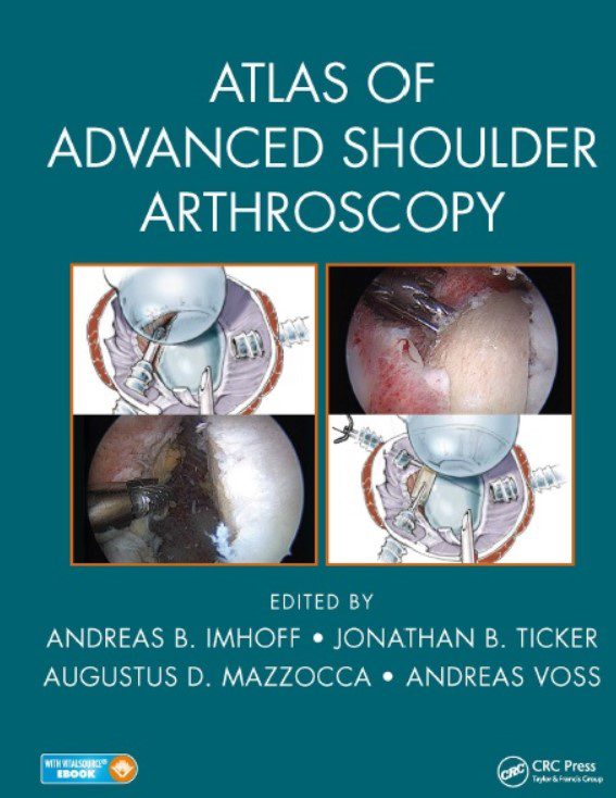 Download Atlas of Advanced Shoulder Arthroscopy PDF Free