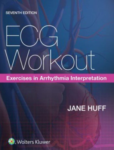Download ECG Workout: Exercises in Arrhythmia Interpretation 7th Edition PDF Free