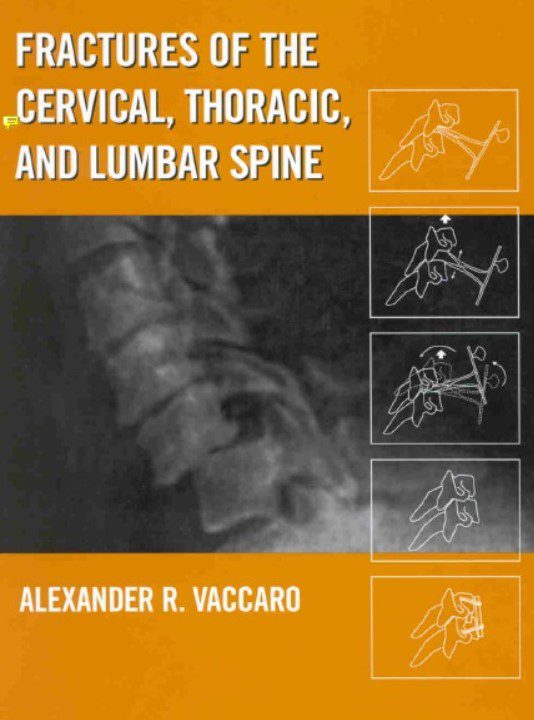 Download Fractures of the Cervical, Thoracic, and Lumbar Spine 1st Edition PDF Free