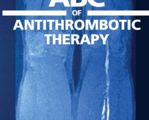 ABC of Antithrombotic Therapy PDF Free Download