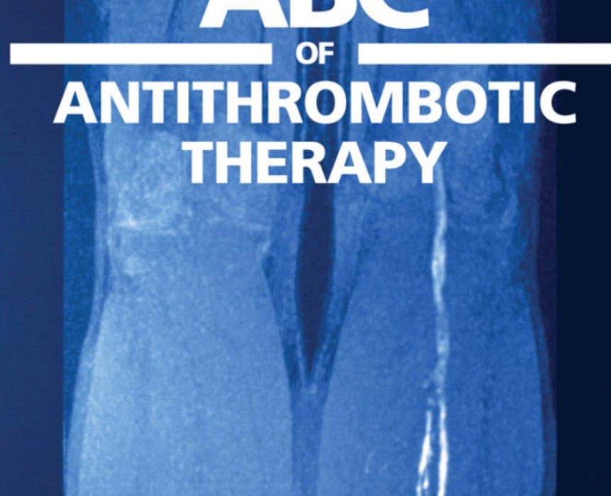 ABC of Antithrombotic Therapy PDF Free Download
