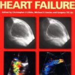 ABC of Heart Failure PDF Free Download