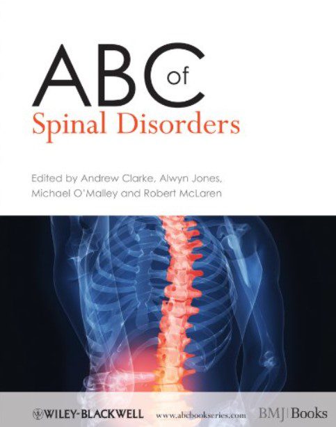 ABC of Spinal Disorders PDF Free Download