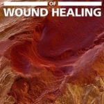 Download ABC of Wound Healing PDF Free