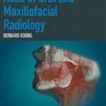 Download Atlas of Oral and Maxillofacial Radiology PDF Free