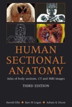Human Sectional Anatomy 3rd Edition PDF Free Download