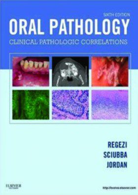 Oral Pathology: Clinical Pathologic Correlations 6th Edition PDF Download