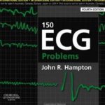 150 ECG problems 4th Edition PDF Free Download