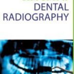 Basic Guide to Dental Radiography PDF Free Download