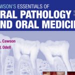 Cawson’s Essentials of Oral Pathology and Oral Medicine 8th Edition PDF Free Download