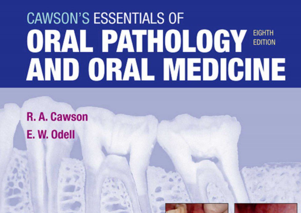 Cawson’s Essentials of Oral Pathology and Oral Medicine 8th Edition PDF Free Download